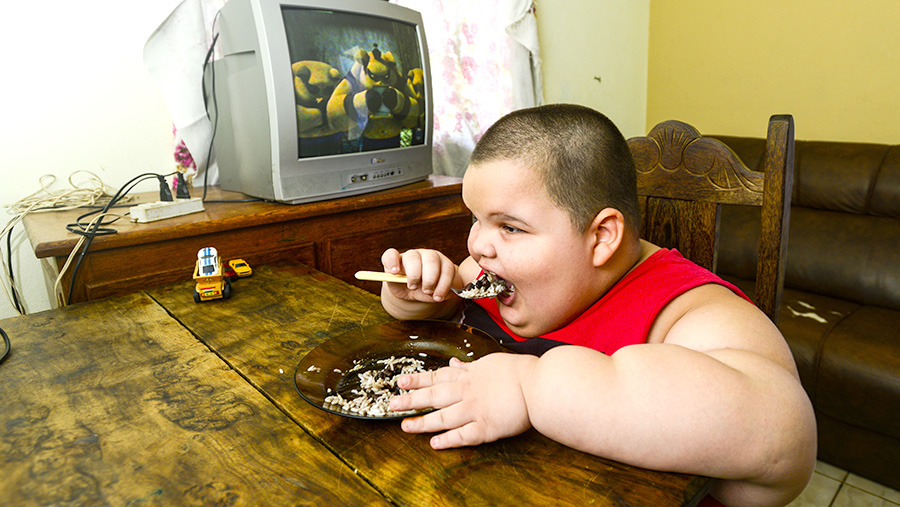 Пятилетний мальчик страдающий ожирением